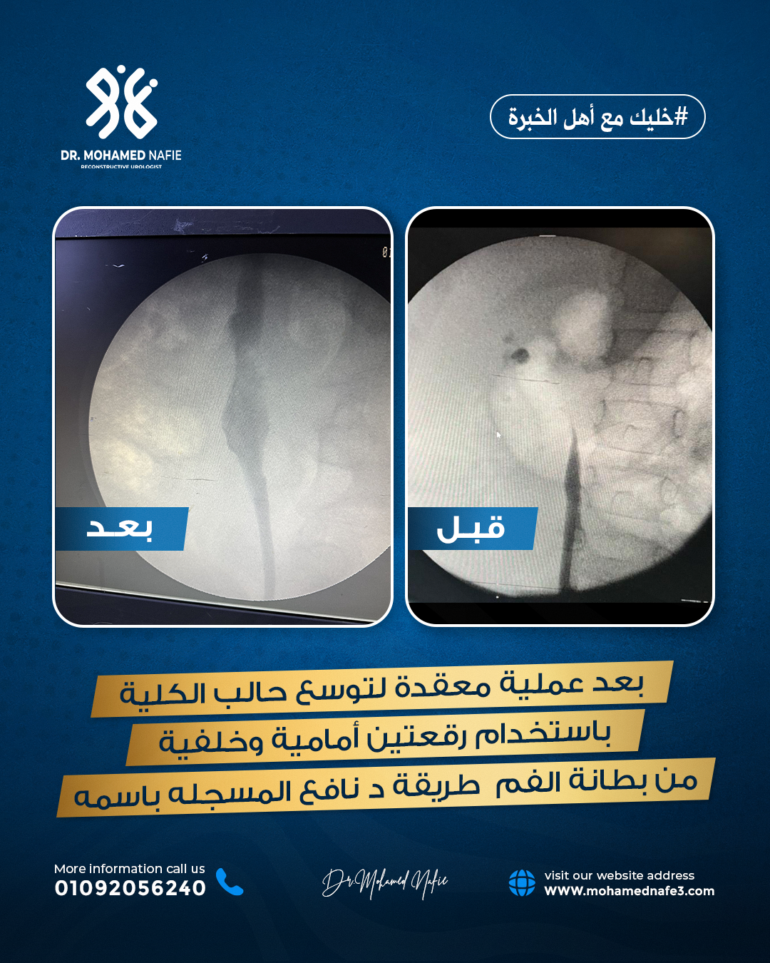 لماذا يُعد الدكتور محمد نافع الأول في الشرق الأوسط؟