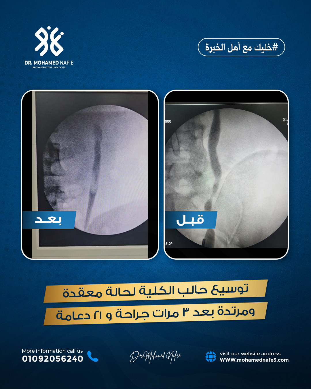 لماذا يُعد الدكتور محمد نافع الأول في الشرق الأوسط؟