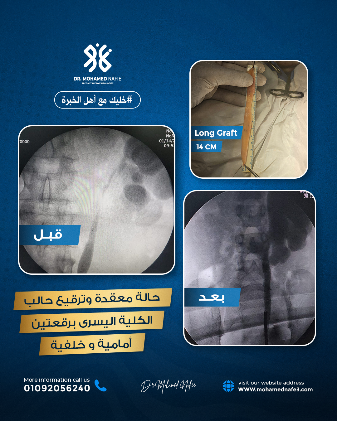لماذا يُعد الدكتور محمد نافع الأول في الشرق الأوسط؟