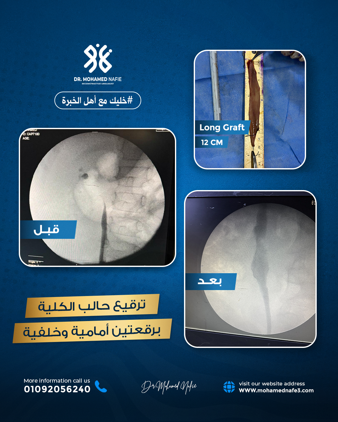 لماذا يُعد الدكتور محمد نافع الأول في الشرق الأوسط؟