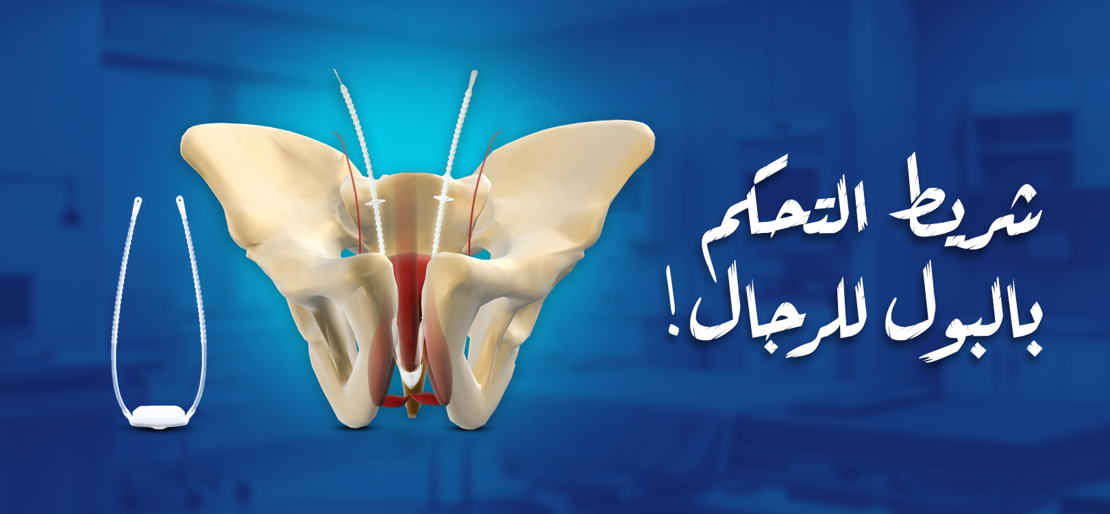 صمام التحكم في مجرى البول