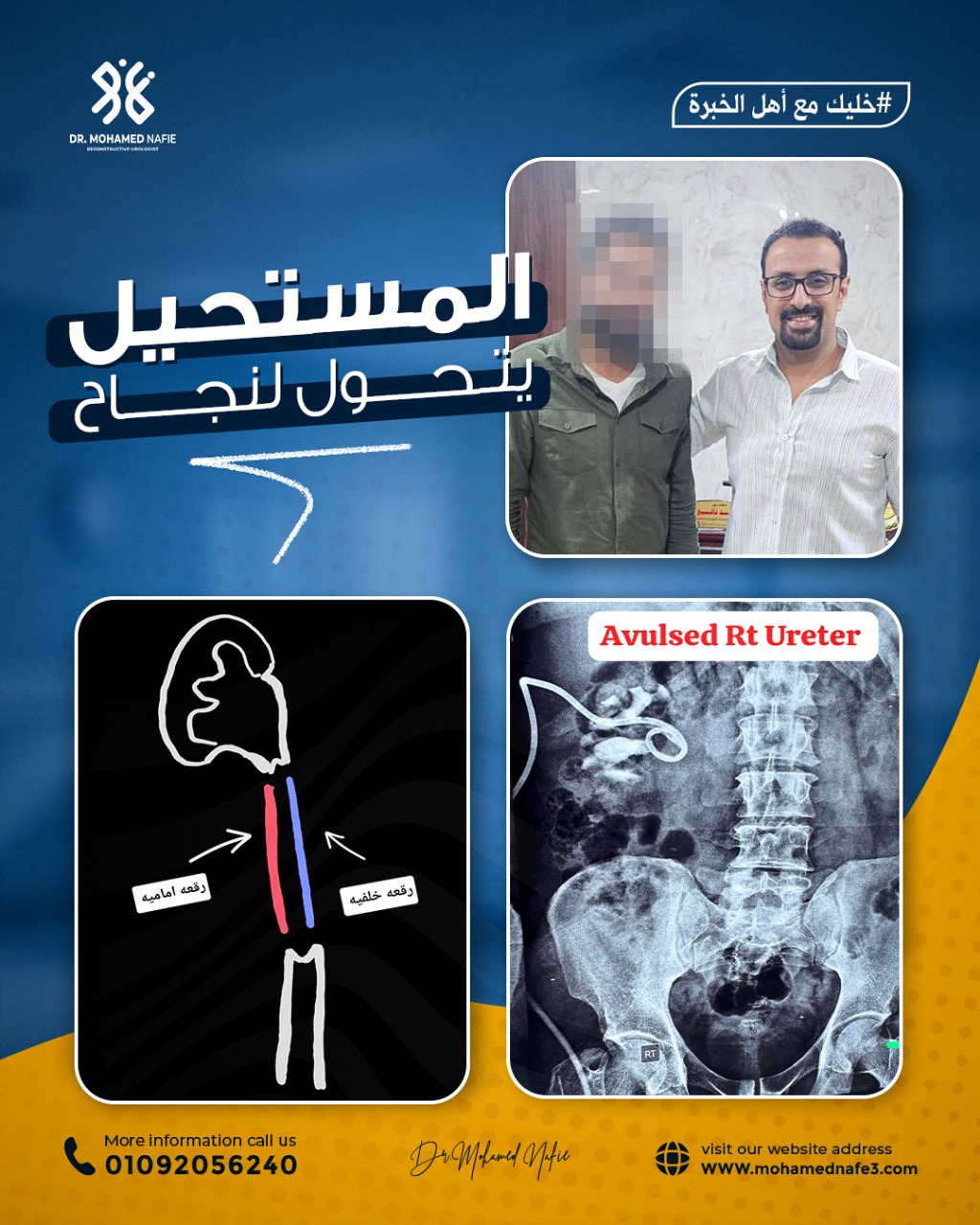  شاب عانى من قطع حالب الكلية… وإنجاز طبي يحافظ على حياته