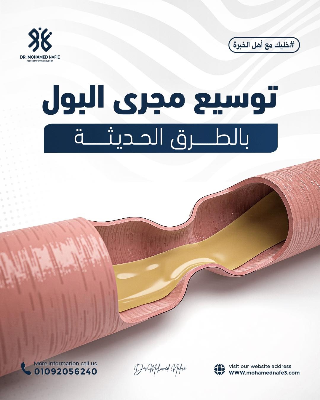  توسيع مجرى البول بالطرق الحديثة