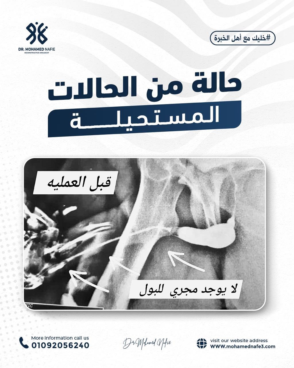 شاب من ليبيا وُلد بدون مجرى بول نهائيًا – قصة إنجاز طبي فريد