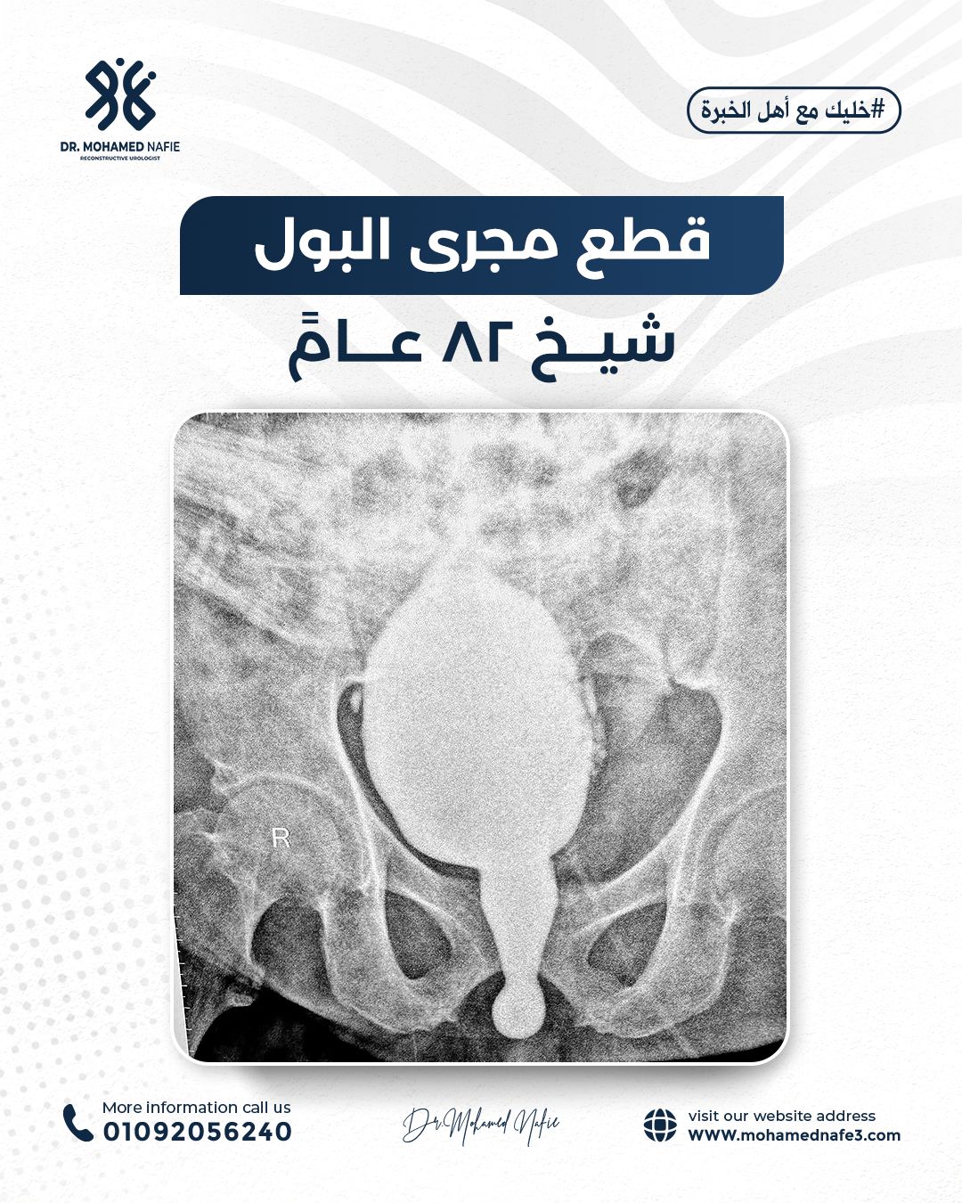 لأول مرة في التاريخ إنجاز طبي غير مسبوق على أرض مصر