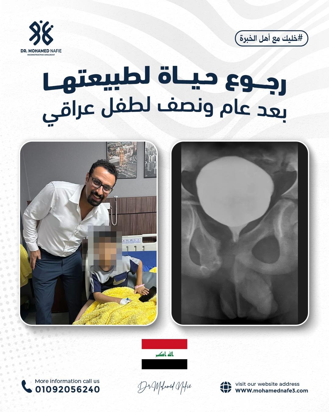  قصة أمل جديدة لطفل عراقي… بعد قطع كامل في مجرى البول