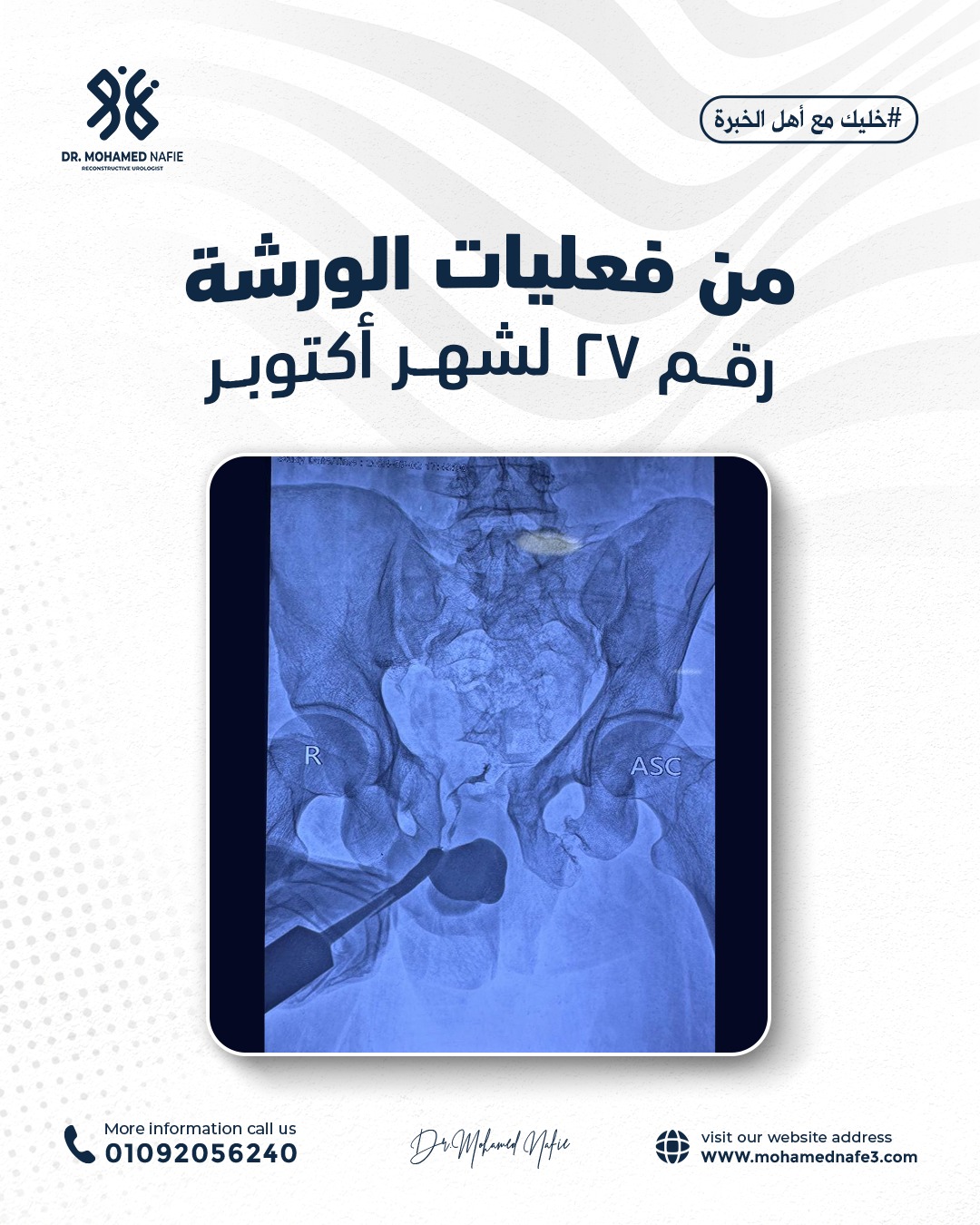 واحدة من أصعب وأدق الورش الجراحية… إنجاز جديد يُضاف إلى سجل النجاح