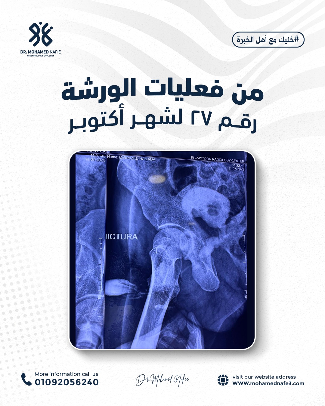 واحدة من أصعب وأدق الورش الجراحية… إنجاز جديد يُضاف إلى سجل النجاح