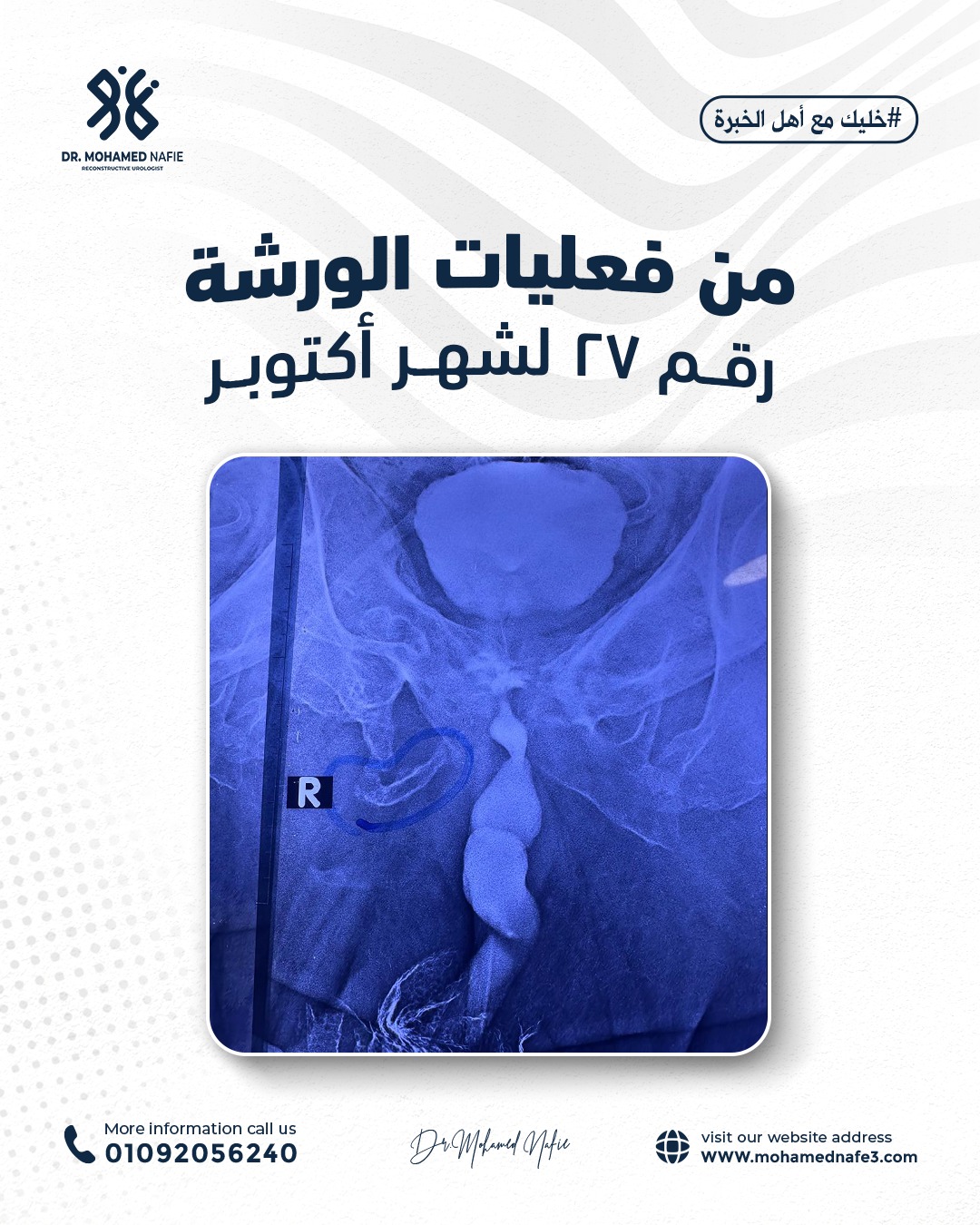 واحدة من أصعب وأدق الورش الجراحية… إنجاز جديد يُضاف إلى سجل النجاح