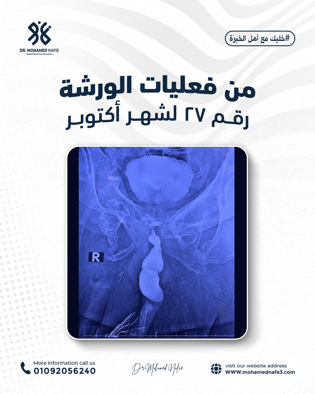 واحدة من أصعب وأدق الورش الجراحية… إنجاز جديد يُضاف إلى سجل النجاح