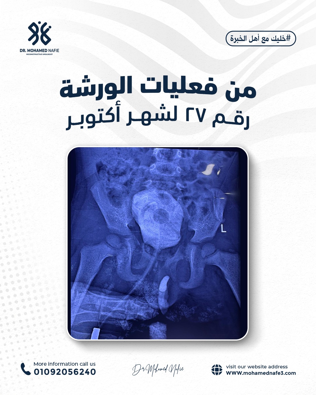 واحدة من أصعب وأدق الورش الجراحية… إنجاز جديد يُضاف إلى سجل النجاح