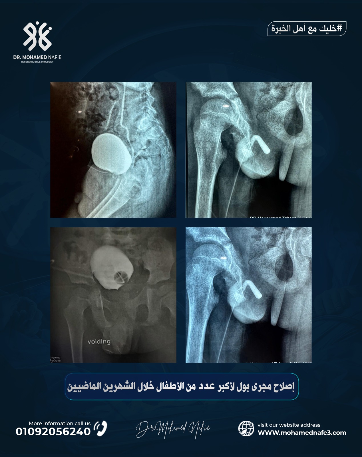 رقم جديد… أمل جديد للأطفال