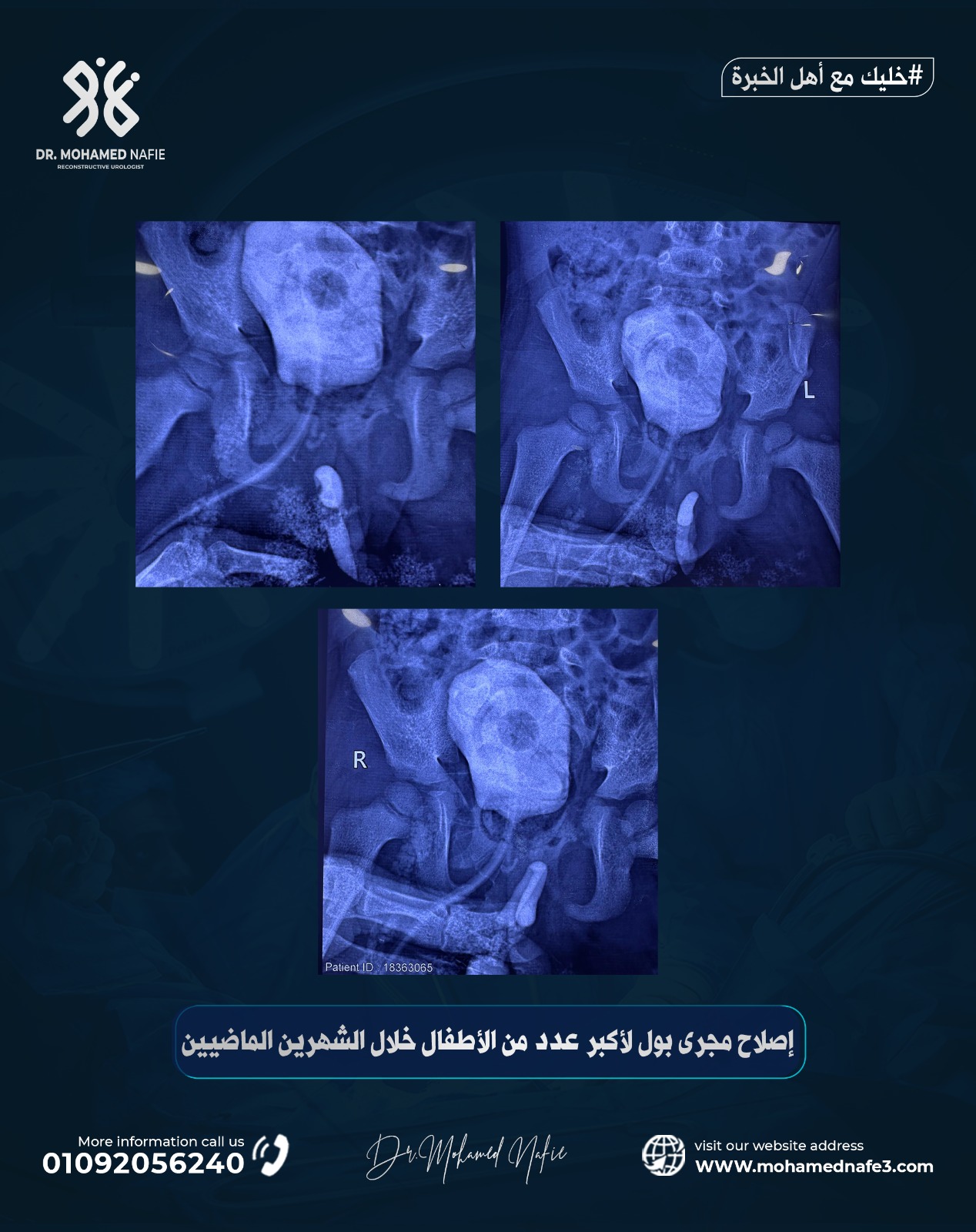 رقم جديد… أمل جديد للأطفال