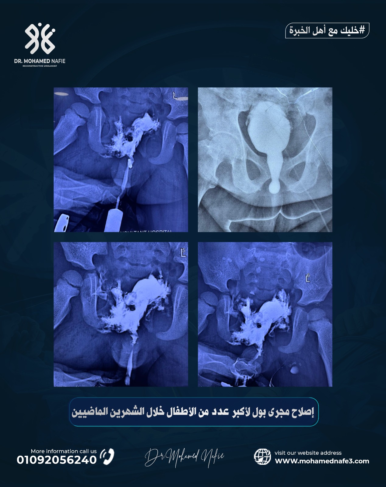 رقم جديد… أمل جديد للأطفال