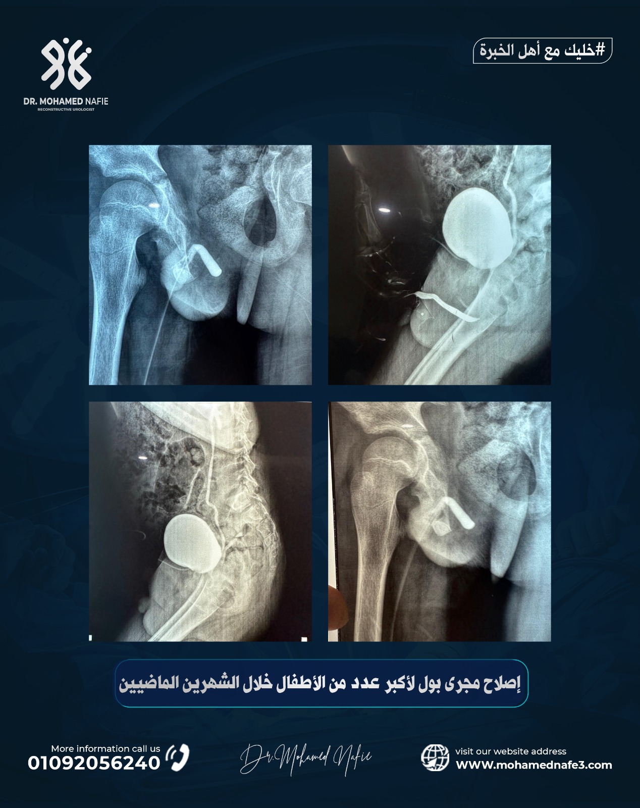 رقم جديد… أمل جديد للأطفال