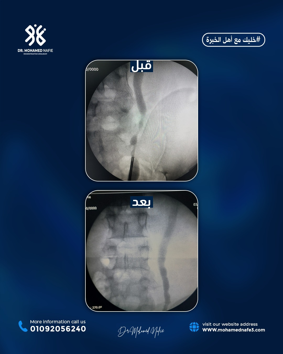حالة من اليمن… نهاية سبع سنوات من الألم بفضل الخبرة والجراحة الدقيقة