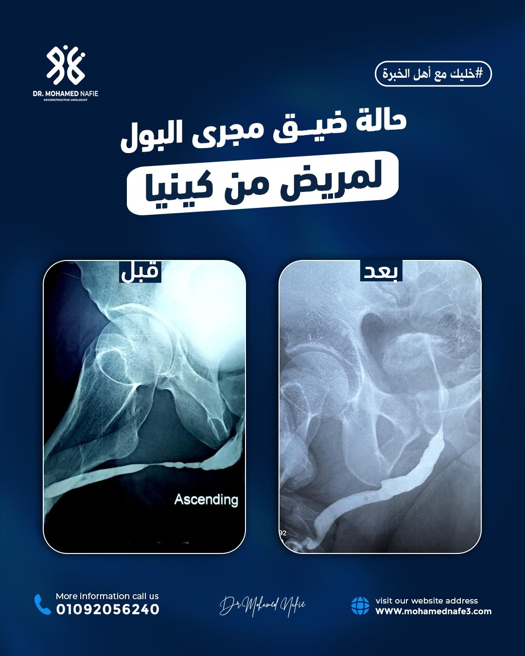 عندما نقول إننا المركز الأكبر لجراحات مجرى البول والحالات المعقّدة…