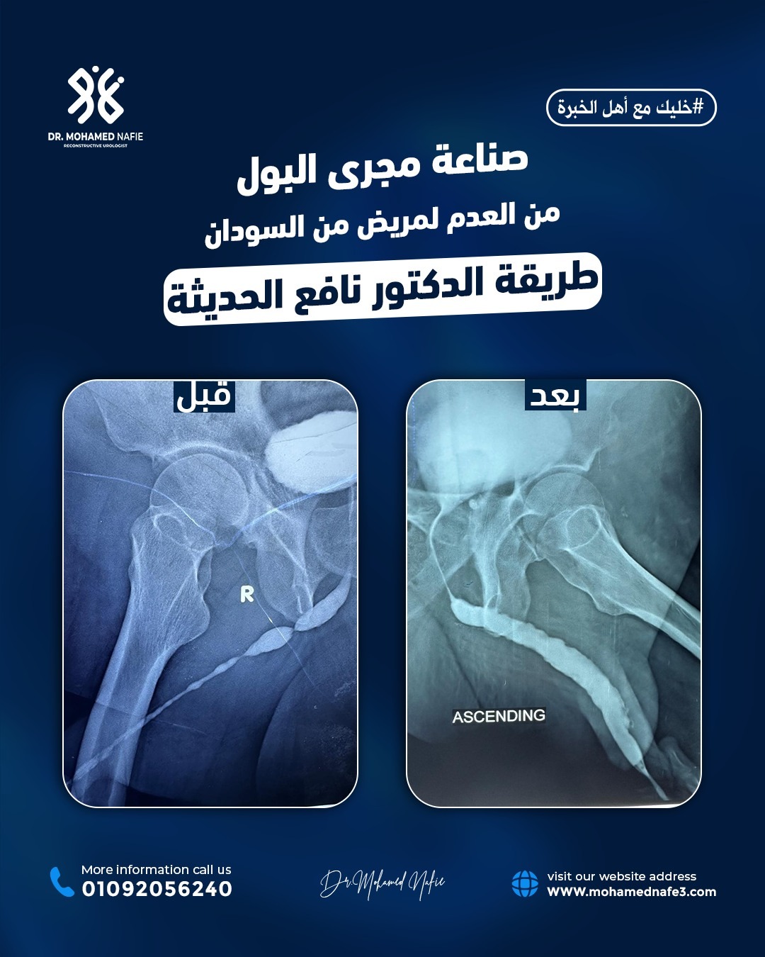 عندما نقول إننا المركز الأكبر لجراحات مجرى البول والحالات المعقّدة…