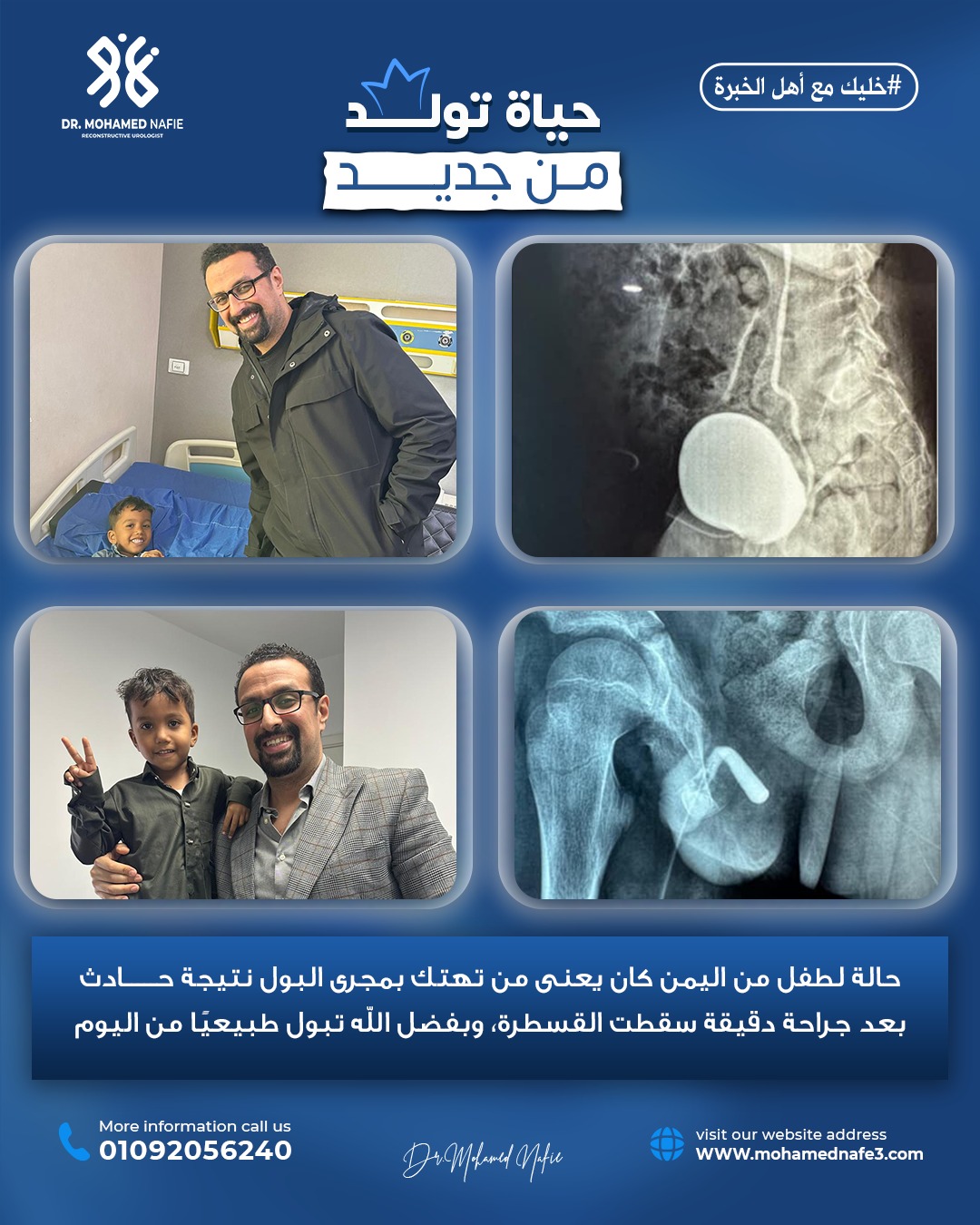  طفل من اليمن الشقيق… رحلة علاج بدأت بالألم وانتهت بالأمل