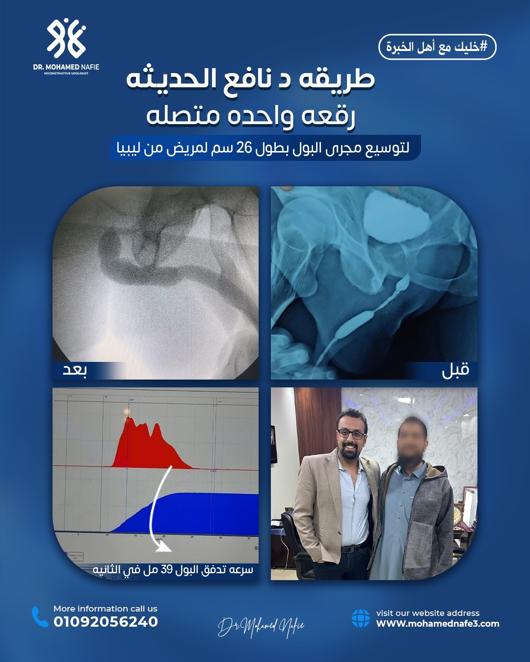  مريض من ليبيا يتغلب على ضيق شديد بمجرى البول بفضل جراحة دقيقة متقدمة