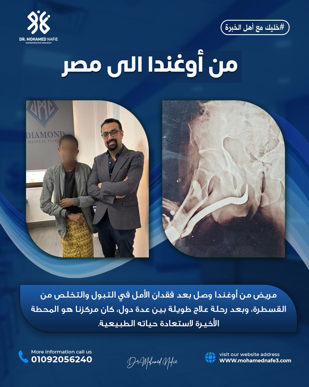  حالة من أكثر الحالات تعقيدًا وصلت إلينا من أوغندا… رحلة علاج انتهت بالأمل والشفاء