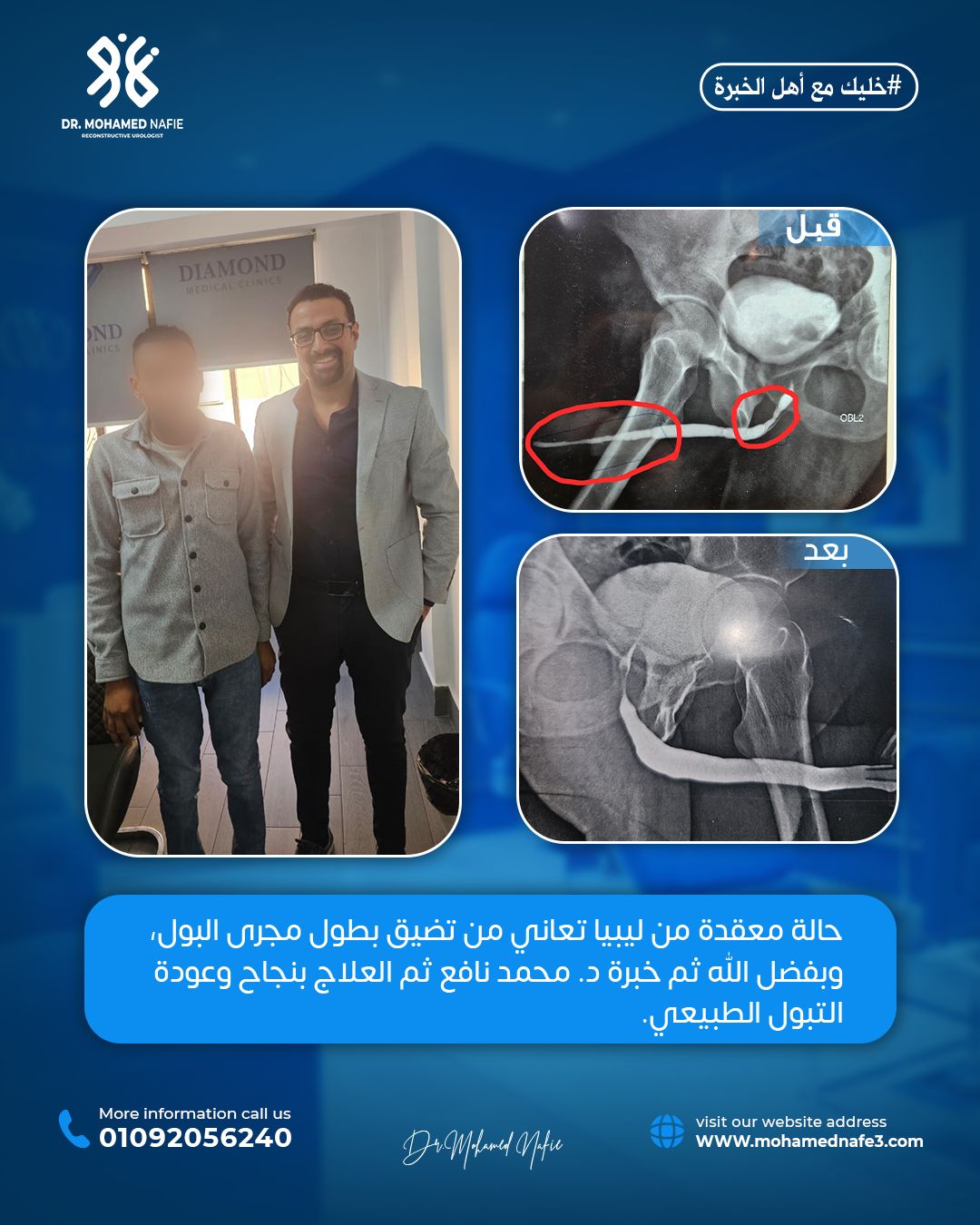  مريض من ليبيا يستعيد حياته بعد معاناة طويلة مع تضيق مجرى البول