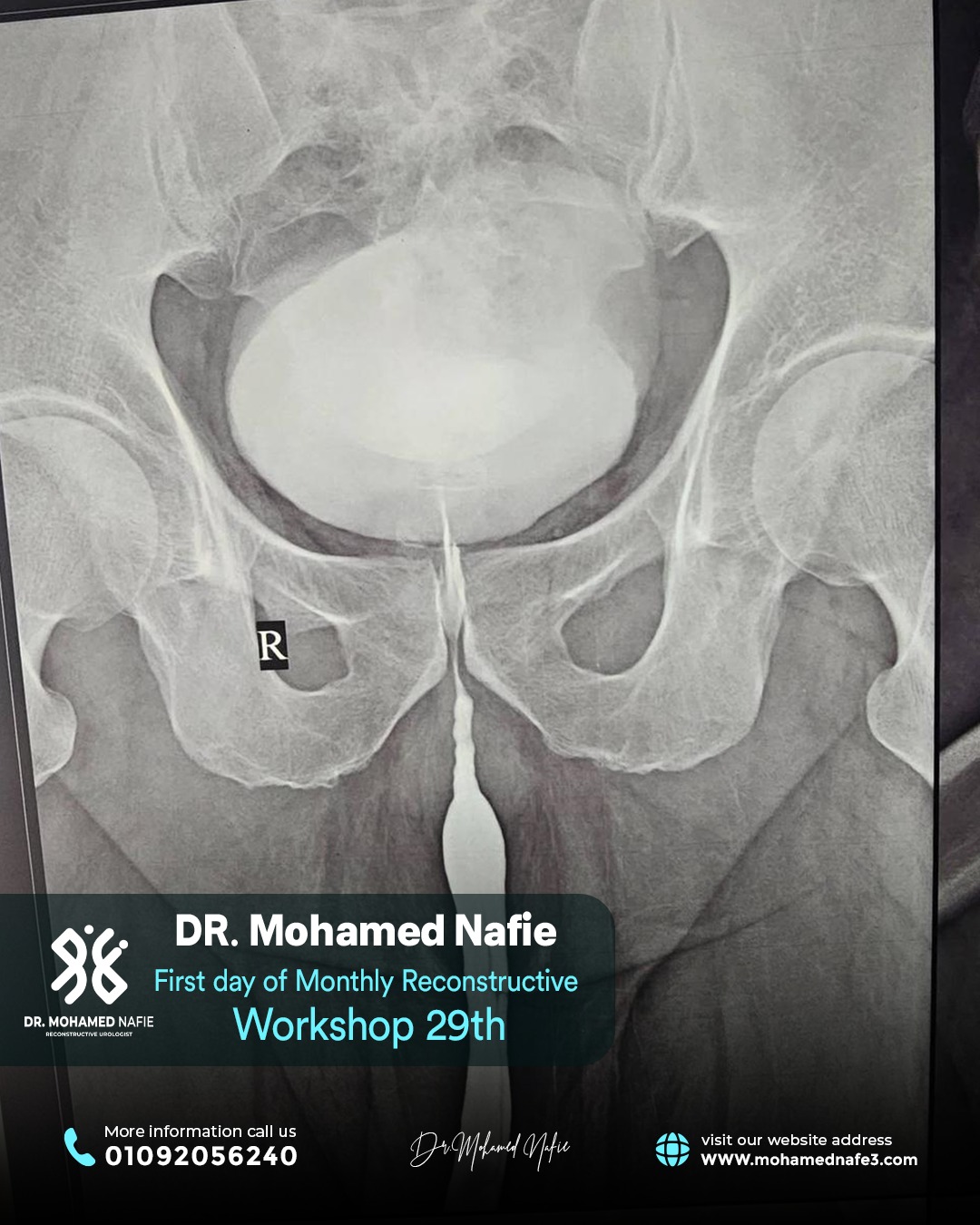 بدأنا الحدث التاريخي… ملحمة طبية تُكتب على أرض مصر