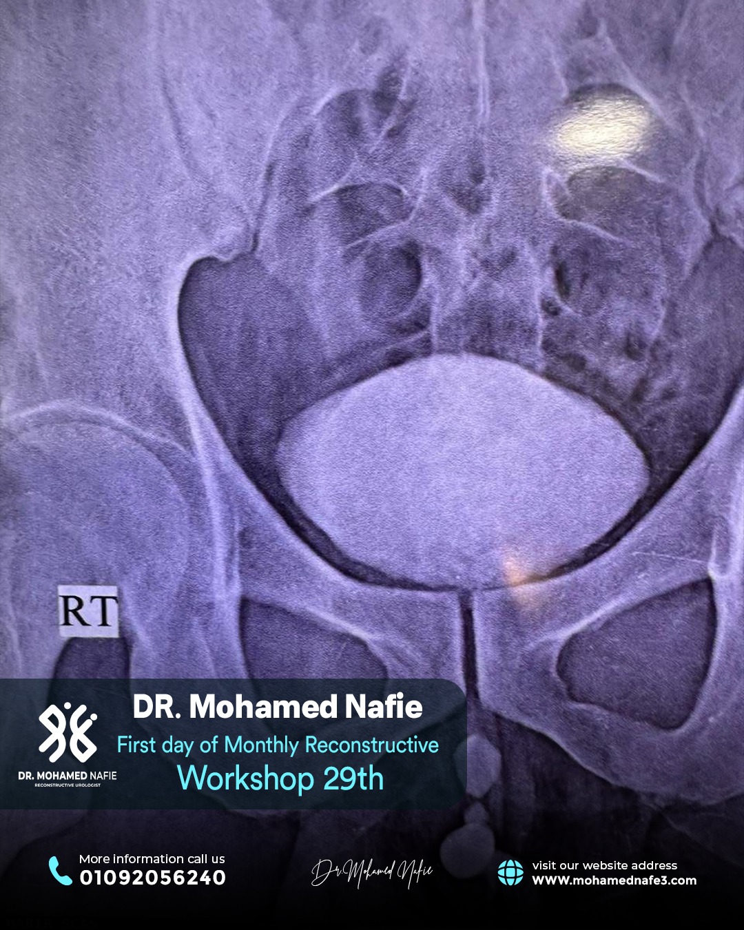 بدأنا الحدث التاريخي… ملحمة طبية تُكتب على أرض مصر