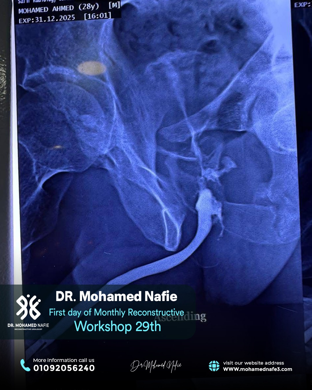 بدأنا الحدث التاريخي… ملحمة طبية تُكتب على أرض مصر