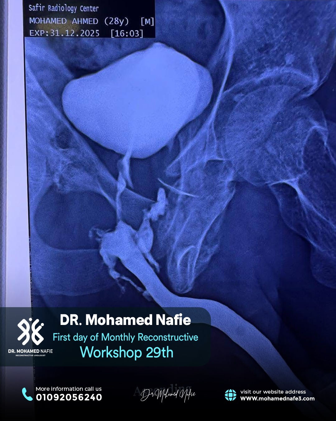 بدأنا الحدث التاريخي… ملحمة طبية تُكتب على أرض مصر