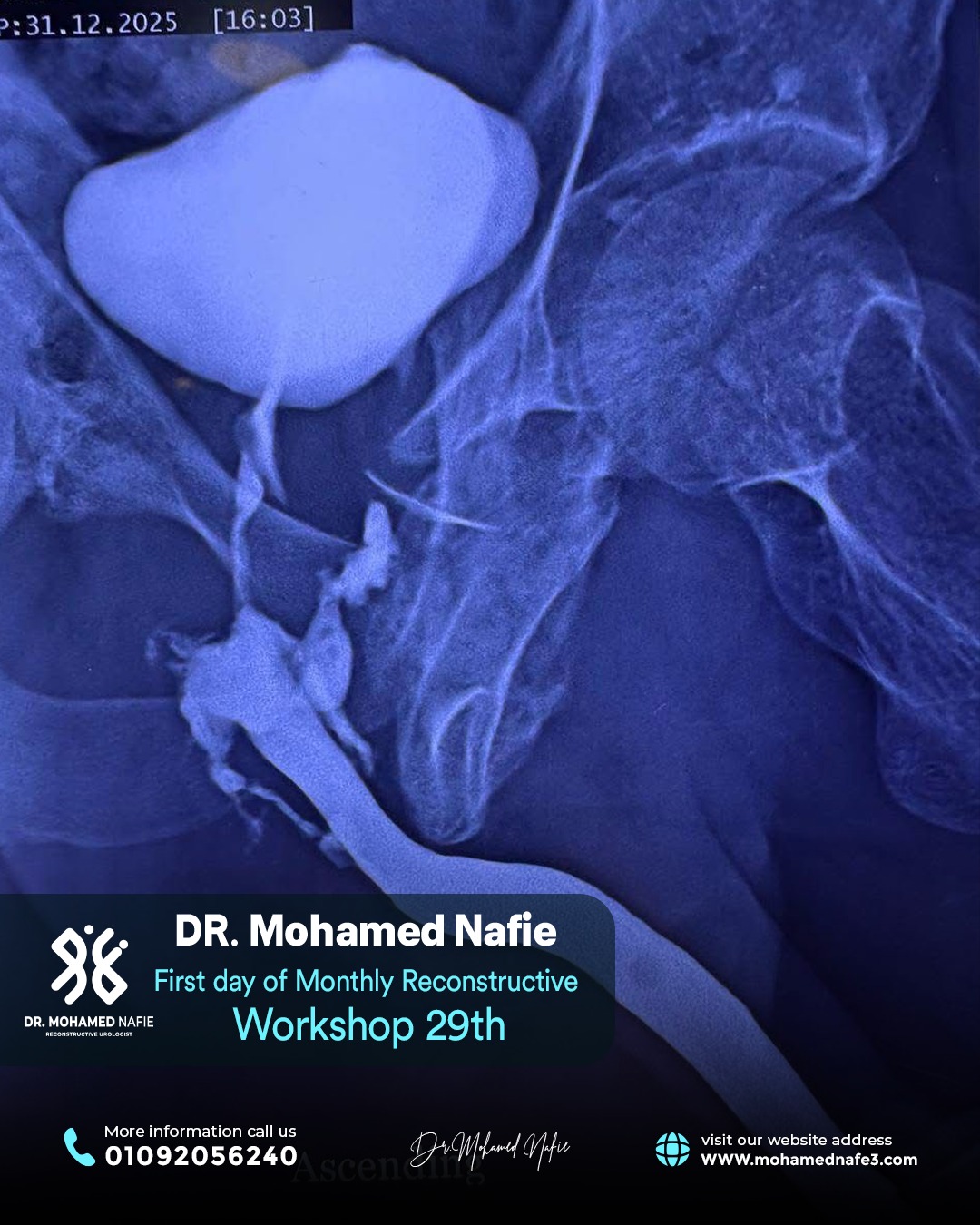 بدأنا الحدث التاريخي… ملحمة طبية تُكتب على أرض مصر