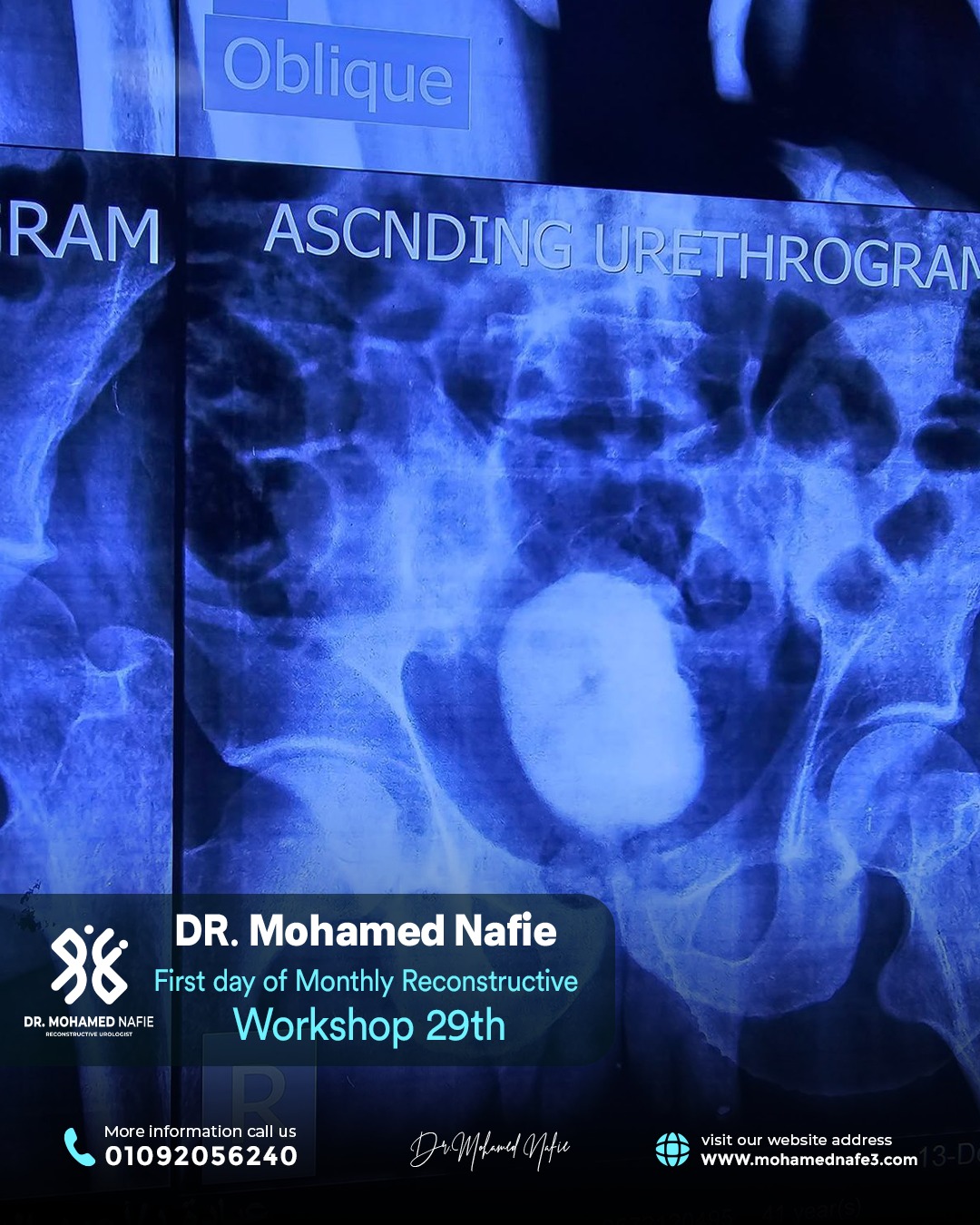 الورشة رقم 29… محطة جديدة في مسيرة التميز الطبي لجراحات مجرى البول