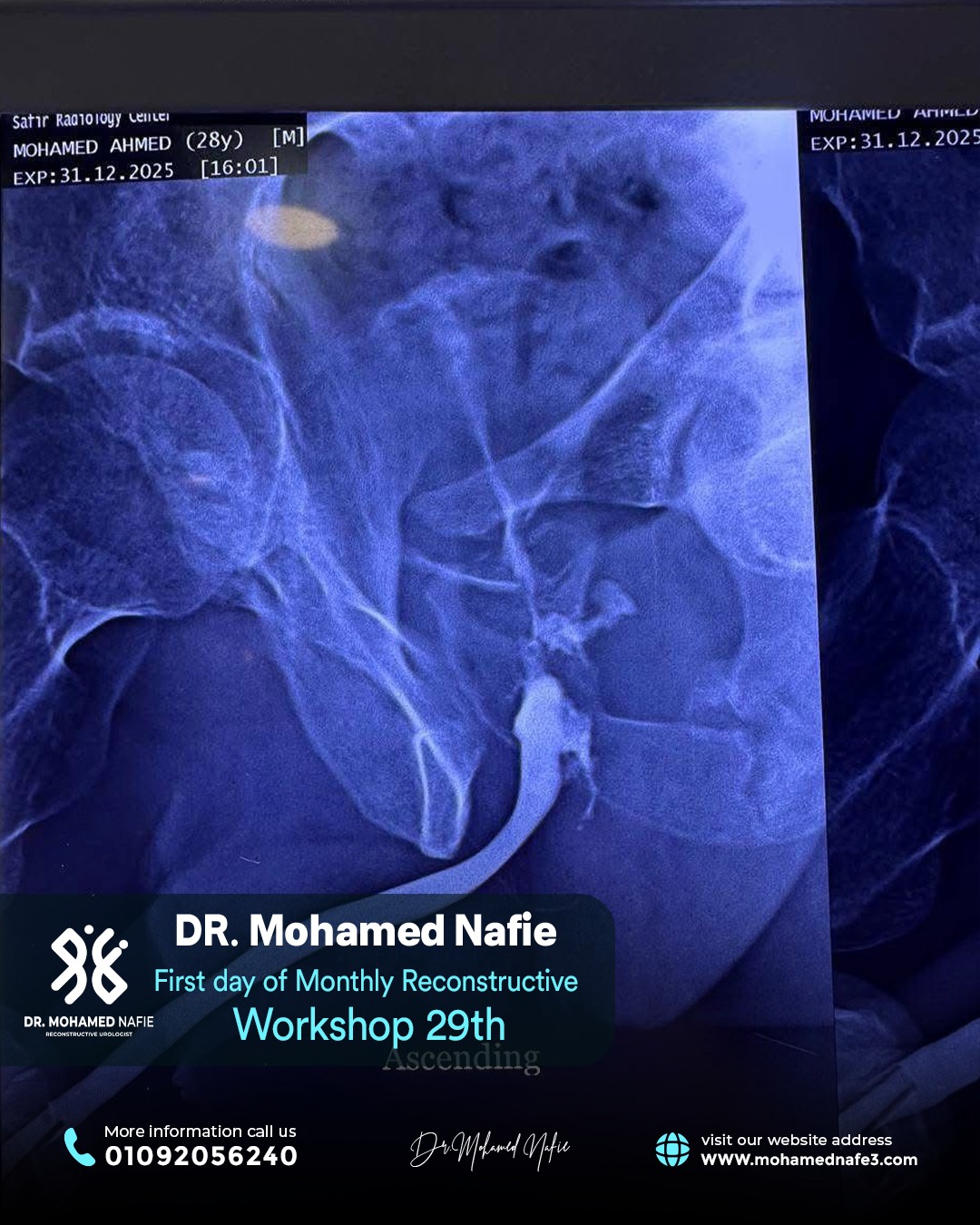 الورشة رقم 29… محطة جديدة في مسيرة التميز الطبي لجراحات مجرى البول
