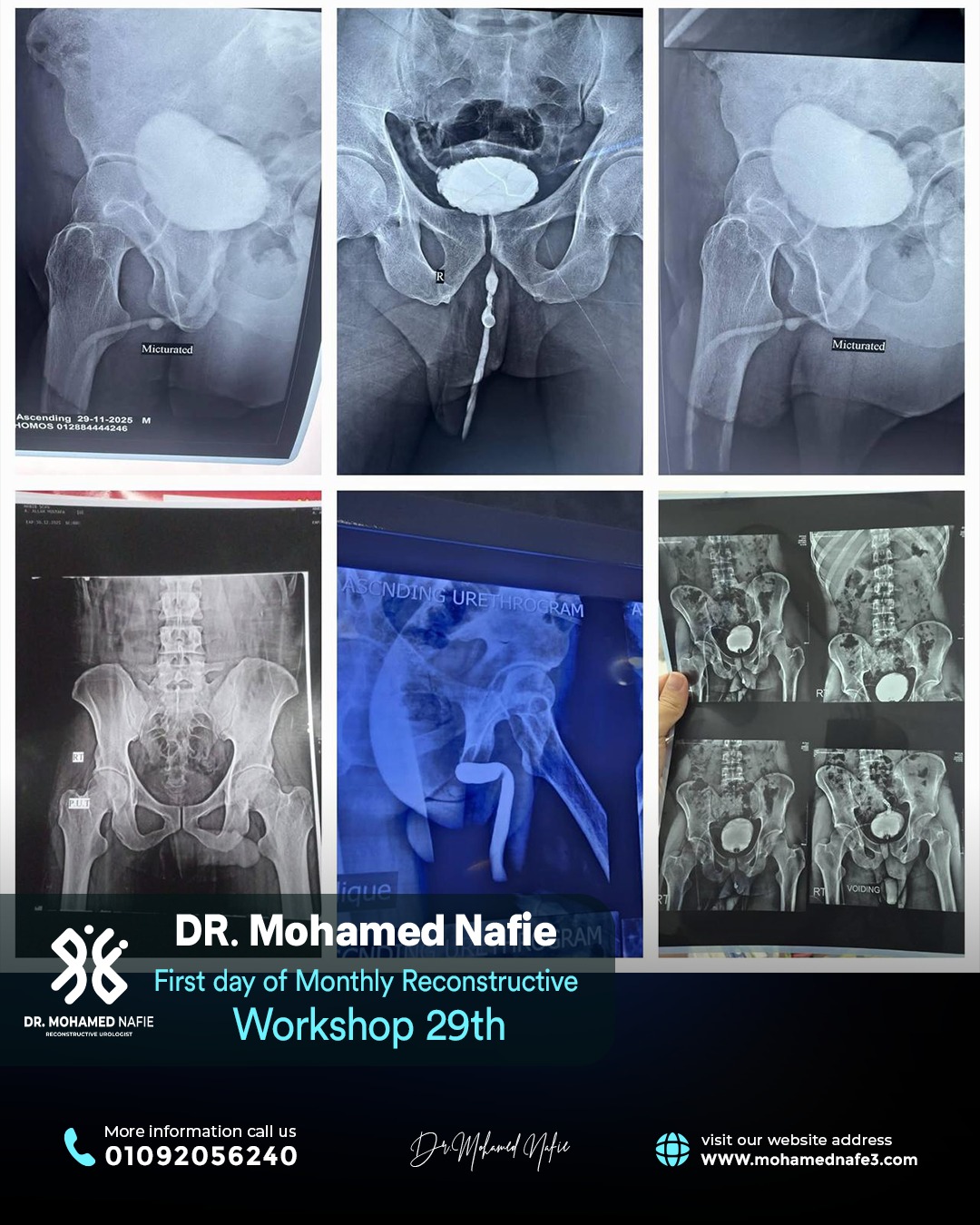 الورشة رقم 29… محطة جديدة في مسيرة التميز الطبي لجراحات مجرى البول