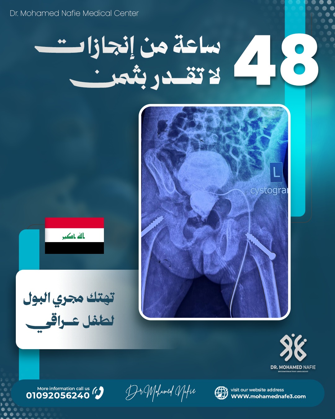 غرفة العمليات تشهد قصص أمل جديدة خلال 48 ساعة في مركز دكتور محمد نافع