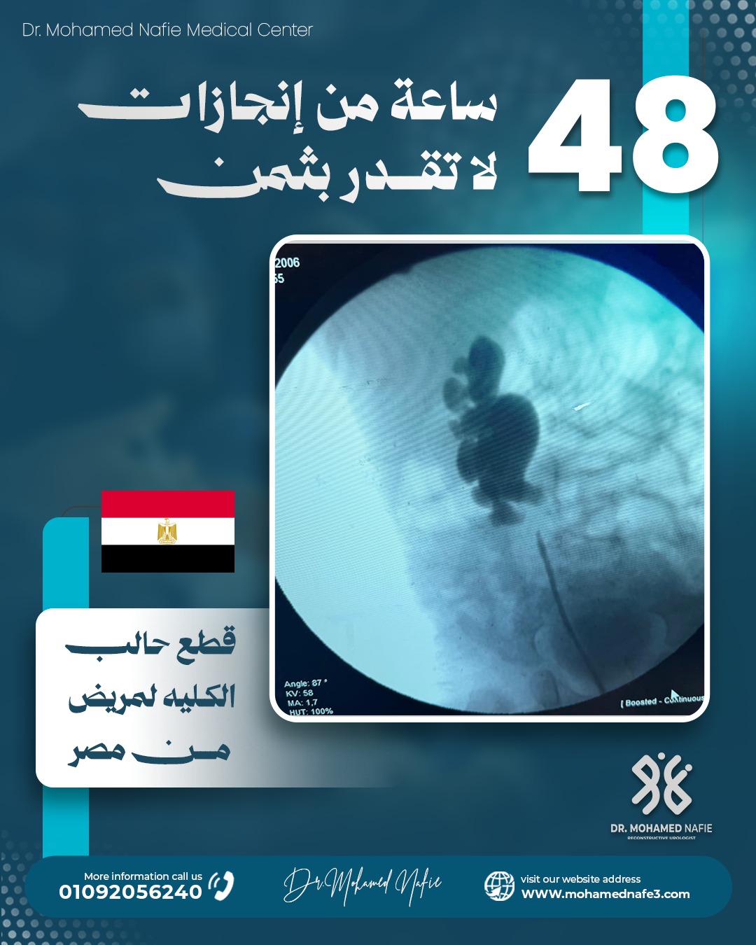 غرفة العمليات تشهد قصص أمل جديدة خلال 48 ساعة في مركز دكتور محمد نافع