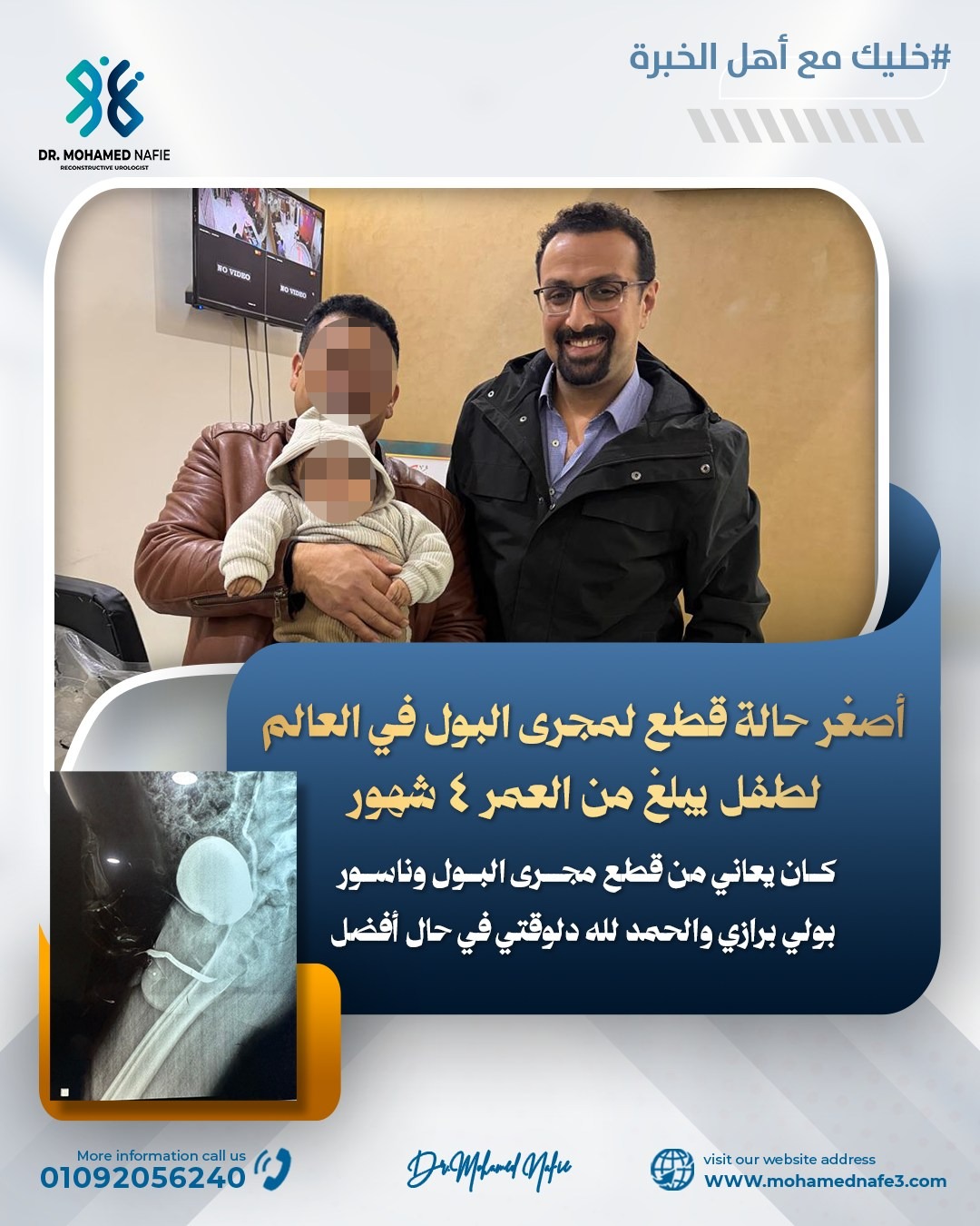  أصغر حالة قطع في مجرى البول على مستوى العالم لطفل عمره 4 شهور