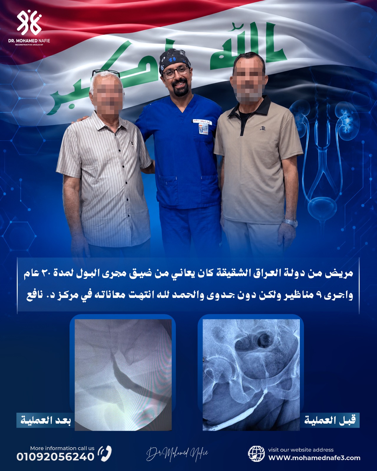  مريض من العراق يتخلص من تضيق مجرى البول بعد 20 عامًا من المعاناة و9 مناظير فاشلة بفضل تقنية د. محمد نافع الحديثة