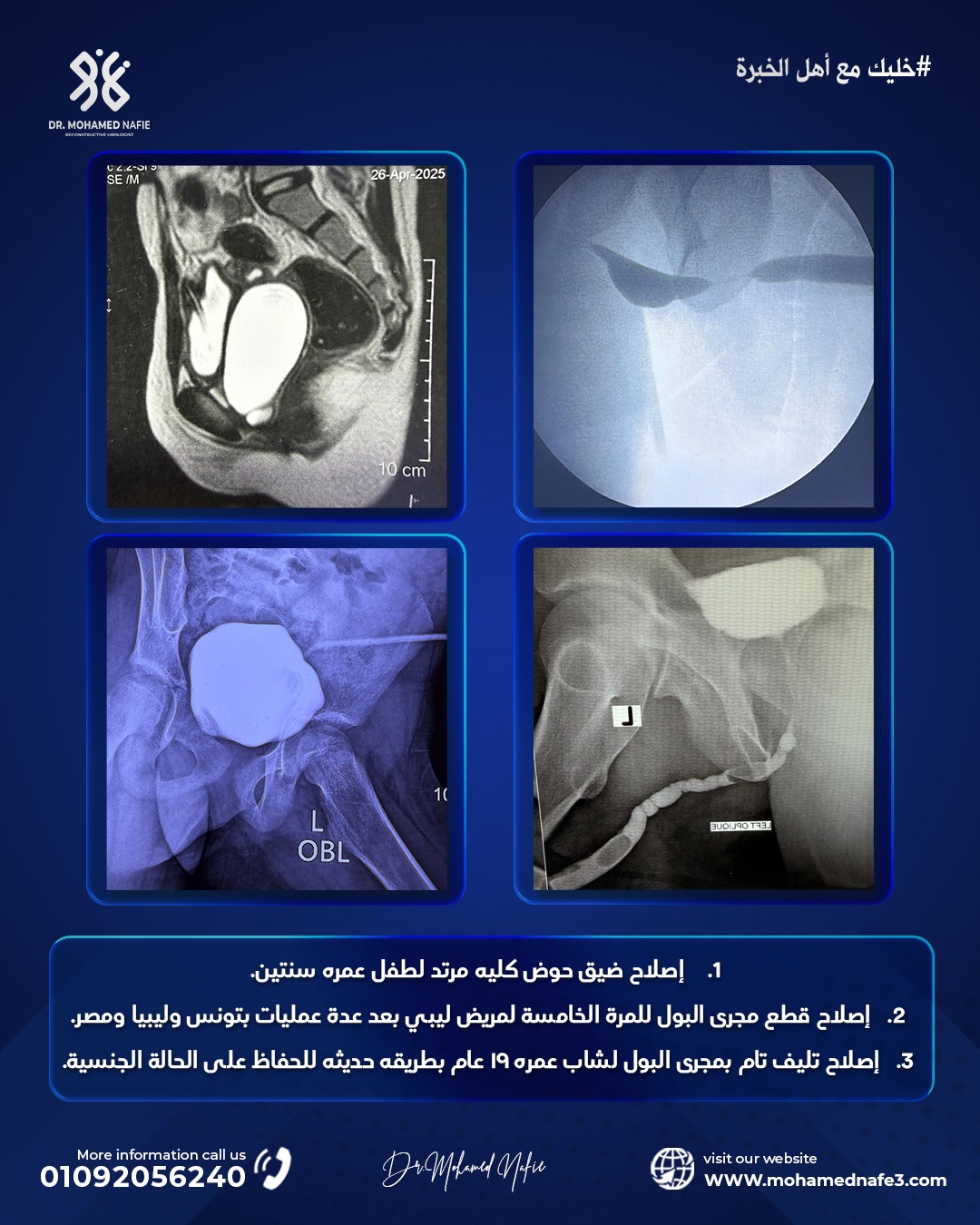 ملحمة طبية وإنجاز استثنائي داخل أكبر وحدة متخصصة في جراحات مجرى البول المعقدة
