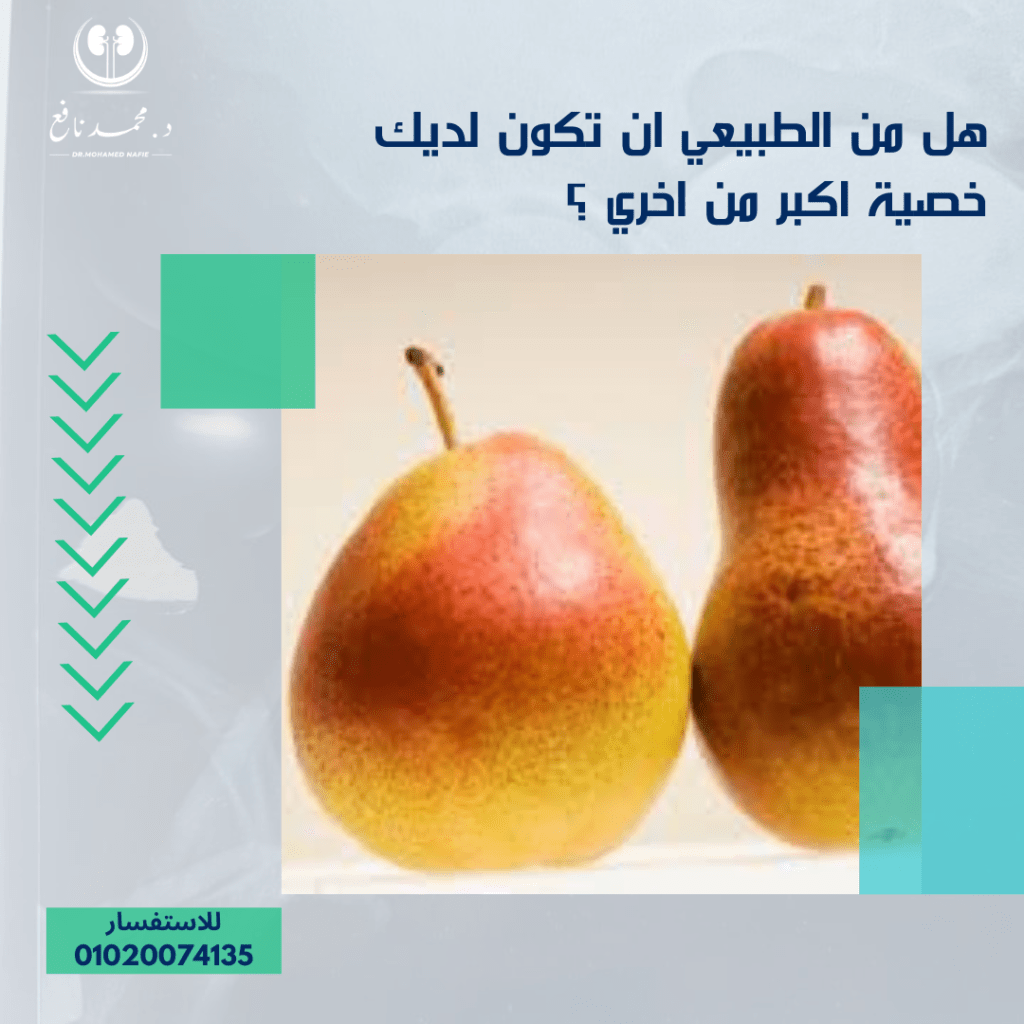 هل من الطبيعي أن يكون لديك خصيتان مختلفتان الحجم؟ دكتور محمد نافع
