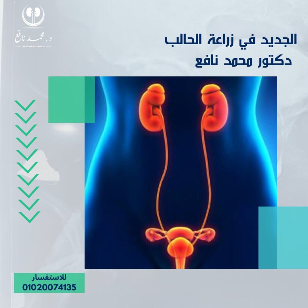 تطورات زرع الحالب جراحياً دكتور محمد نافع
